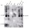 FA Complementation Group D2 antibody, NB100-316, Novus Biologicals, Western Blot image 