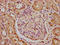Kinesin-like protein KIF23 antibody, LS-C680715, Lifespan Biosciences, Immunohistochemistry paraffin image 
