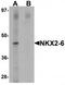 NK2 Homeobox 6 antibody, TA320107, Origene, Western Blot image 
