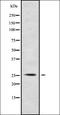 Proprotein convertase subtilisin/kexin type 7 antibody, orb338257, Biorbyt, Western Blot image 