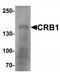Crumbs homolog 1 antibody, TA319859, Origene, Western Blot image 