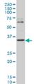 Zic Family Member 4 antibody, H00084107-M07, Novus Biologicals, Western Blot image 