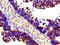 Histone Cluster 1 H1 Family Member E antibody, LS-C670385, Lifespan Biosciences, Immunohistochemistry paraffin image 