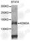 Lysine Demethylase 3A antibody, A2322, ABclonal Technology, Western Blot image 