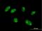 Katanin Catalytic Subunit A1 Like 2 antibody, H00083473-B01P, Novus Biologicals, Immunocytochemistry image 