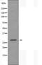 Dehydrogenase/reductase SDR family member 4 antibody, orb226507, Biorbyt, Western Blot image 