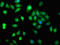 Stromelysin-3 antibody, LS-C672829, Lifespan Biosciences, Immunofluorescence image 