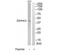 Zinc Finger DHHC-Type Containing 2 antibody, TA315449, Origene, Western Blot image 