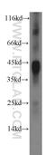 Interleukin 12B antibody, 17645-1-AP, Proteintech Group, Western Blot image 