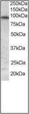 Forkhead Box O3 antibody, AP23030PU-N, Origene, Western Blot image 