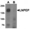 Leucyl And Cystinyl Aminopeptidase antibody, TA319678, Origene, Western Blot image 