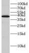 3-Hydroxyisobutyryl-CoA Hydrolase antibody, FNab03856, FineTest, Western Blot image 