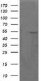 Parvin Alpha antibody, CF506025, Origene, Western Blot image 