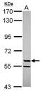 Cytochrome P450 Family 3 Subfamily A Member 4 antibody, PA5-28323, Invitrogen Antibodies, Western Blot image 