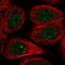 DNA repair protein RAD51 homolog 2 antibody, HPA051869, Atlas Antibodies, Immunofluorescence image 