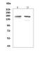 ASXL Transcriptional Regulator 1 antibody, A01099-1, Boster Biological Technology, Western Blot image 