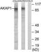 A-Kinase Anchoring Protein 1 antibody, TA314719, Origene, Western Blot image 