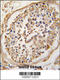 Neuronal pentraxin-2 antibody, LS-C98577, Lifespan Biosciences, Immunohistochemistry paraffin image 