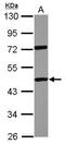 DEAD-Box Helicase 19A antibody, GTX118765, GeneTex, Western Blot image 