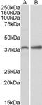 Sulfatase Modifying Factor 1 antibody, 42-188, ProSci, Enzyme Linked Immunosorbent Assay image 
