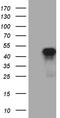 Homeobox protein SIX3 antibody, LS-C792775, Lifespan Biosciences, Western Blot image 