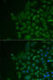 Lecithin Retinol Acyltransferase antibody, LS-C748315, Lifespan Biosciences, Immunofluorescence image 