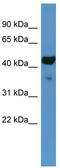 FA2H antibody, TA331746, Origene, Western Blot image 
