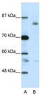 Leucine Zipper Like Transcription Regulator 1 antibody, TA343637, Origene, Western Blot image 