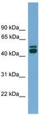 Calregulin antibody, TA344177, Origene, Western Blot image 