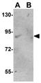 GRB2 Associated Regulator Of MAPK1 Subtype 1 antibody, GTX85231, GeneTex, Western Blot image 