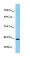 Rho GTPase Activating Protein 33 antibody, orb326855, Biorbyt, Western Blot image 