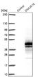 DnaJ Heat Shock Protein Family (Hsp40) Member C18 antibody, NBP1-81137, Novus Biologicals, Western Blot image 