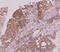 C-Type Lectin Domain Family 4 Member E antibody, MBS200192, MyBioSource, Immunohistochemistry paraffin image 