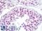 Centrosomal Protein 152 antibody, LS-C119832, Lifespan Biosciences, Immunohistochemistry paraffin image 