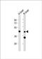 WAS/WASL Interacting Protein Family Member 3 antibody, PA5-72271, Invitrogen Antibodies, Western Blot image 
