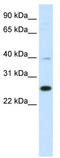 YY1 Associated Factor 2 antibody, TA329928, Origene, Western Blot image 