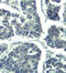 Phospholipase C Gamma 2 antibody, STJ22336, St John