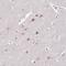 Actin Related Protein 3 antibody, HPA047016, Atlas Antibodies, Immunohistochemistry paraffin image 