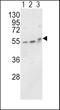 Alkaline Phosphatase, Biomineralization Associated antibody, LS-C98218, Lifespan Biosciences, Western Blot image 