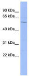 Dachshund Family Transcription Factor 1 antibody, TA345489, Origene, Western Blot image 