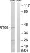 Mitochondrial Ribosomal Protein S9 antibody, TA315755, Origene, Western Blot image 