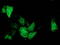 ADP-ribosylation factor GTPase-activating protein 1 antibody, M04959, Boster Biological Technology, Immunofluorescence image 