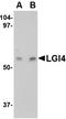 Leucine-rich repeat LGI family member 4 antibody, AP22675PU-N, Origene, Western Blot image 
