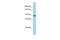 Protein Phosphatase 4 Regulatory Subunit 4 antibody, A14792, Boster Biological Technology, Western Blot image 