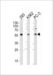 PtdIns(4)P-5-kinase-like protein 1 antibody, 55-769, ProSci, Western Blot image 