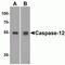 Caspase-12 antibody, NBP1-76801, Novus Biologicals, Western Blot image 