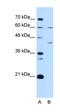 Replication factor C subunit 5 antibody, orb325254, Biorbyt, Western Blot image 