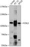 Fc Receptor Like 5 antibody, GTX66209, GeneTex, Western Blot image 