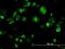 Mitogen-activated protein kinase 12 antibody, H00006300-M04, Novus Biologicals, Immunocytochemistry image 