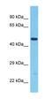 Dynein Axonemal Assembly Factor 1 antibody, orb327414, Biorbyt, Western Blot image 